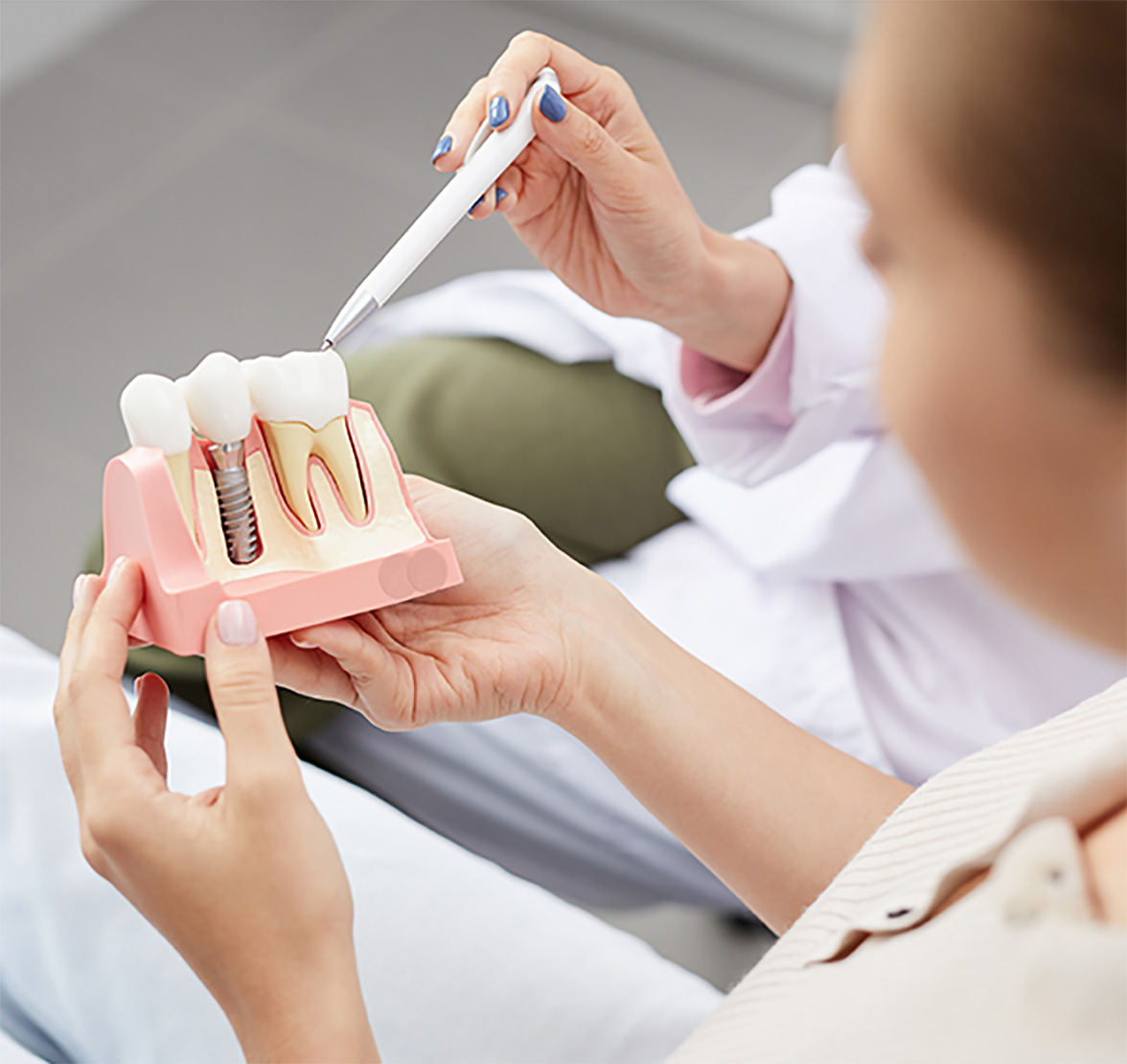 dentist holding a dental implants model